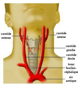 Le triangle permet de compresser les 2 carotides qui se trouvent de chaque côté du cou. 